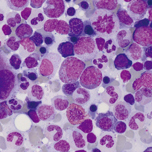 Seconda Giornata dell'Ematologia e Oncoematologia,