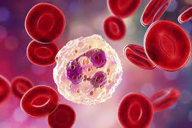 Ematologia