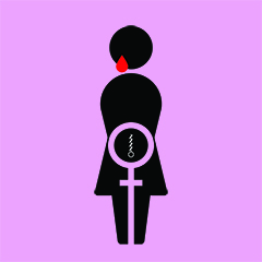 Mutilazioni genitali femminili