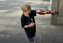 Bambino nato senza mano diventa un supereroe Bambino