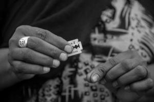 Mutilazione genitale femminile