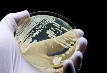 Candida auris: il super fungo che allarma l’Europa Candida auris,