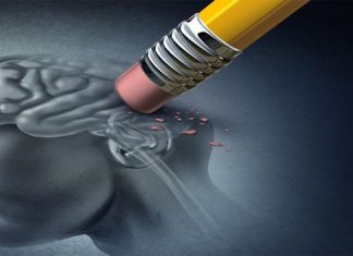 La demenza non è solo questione di cellule cerebrali